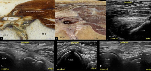 Rodilla posterior 1.jpg